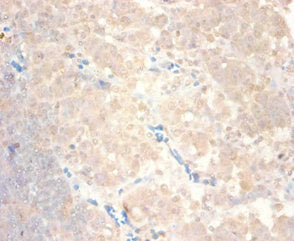 Immunohistochemistry of paraffin-embedded human lymph node tissue using CSB-PA05909A0Rb at dilution of 1:100