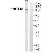 Western blot analysis of extracts from NIH/3T3 cells, using RHG11A antibody.