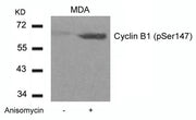 Western blot analysis of extracts from MDA cells untreated or treated with Anisomycin using Cyclin B1(phospho-Ser147) Antibody.