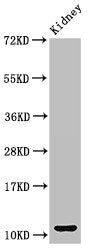 Western Blot Positive WB detected in: Mouse kidney tissue All lanes: CCL3 antibody at 3ug/ml Secondary Goat polyclonal to rabbit IgG at 1/50000 dilution Predicted band size: 11 kDa Observed band size: 11 kDa