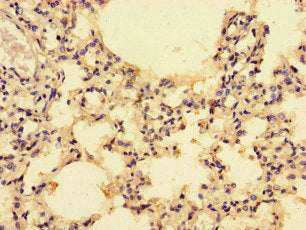 Immunohistochemistry of paraffin-embedded human lung tissue using CSB-PA05949A0Rb at dilution of 1:100