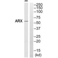 Western blot analysis of extracts from 293 cells, using ARX antibody.
