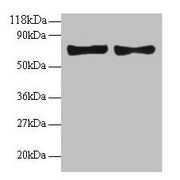 Western blot All lanes: CCL5 antibody at 2µg/ml Lane 1: EC109 whole cell lysate Lane 2: 293T whole cell lysate Secondary Goat polyclonal to rabbit IgG at 1/15000 dilution Predicted band size: 10 kDa Observed band size: 70 kDa