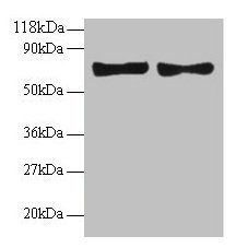 Western blot All lanes: CCL5 antibody at 2µg/ml Lane 1: EC109 whole cell lysate Lane 2: 293T whole cell lysate Secondary Goat polyclonal to rabbit IgG at 1/15000 dilution Predicted band size: 10 kDa Observed band size: 70 kDa