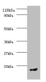 Western blot All lanes: CCL5 antibody at 2µg/ml + PMBC whole cell lysate Secondary Goat polyclonal to rabbit IgG at 1/10000 dilution Predicted band size: 10 kDa Observed band size: 10 kDa