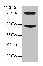 Western blot All lanes: CCL7 antibody at 2µg/ml + 293T whole cell lysate Secondary Goat polyclonal to rabbit IgG at 1/15000 dilution Predicted band size: 12 kDa Observed band size: 48, 90 kDa