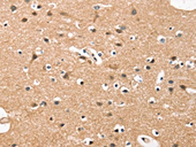 The image on the left is immunohistochemistry of paraffin-embedded Human brain tissue using CSB-PA059735(HDAC8 Antibody) at dilution 1/50, on the right is treated with fusion protein. (Original magnification: ×200)