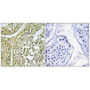Immunohistochemistry analysis of paraffin-embedded human testis tissue, using CKI-α1/L antibody.