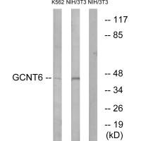 Western blot analysis of extracts from K562 cells and NIH/3T3 cells, using GCNT6 antibody.