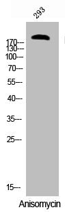 Western Blot analysis of 293 cells using Phospho-Tuberin (S939) Polyclonal Antibody