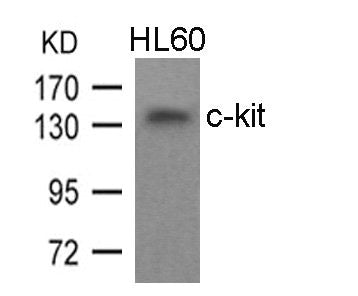 Western blot analysis of extracts from HL60 cells using c-kit(Ab-936) Antibody.