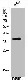 Western Blot analysis of COLO cells using Phospho-VDR (S51) Polyclonal Antibody