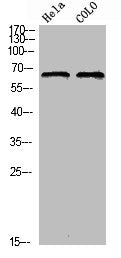 Western blot analysis of HELA COLO using Phospho-Ezrin (T566) antibody.