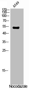 Western Blot analysis of A549 cells using Phospho-Vimentin (S56) Polyclonal Antibody