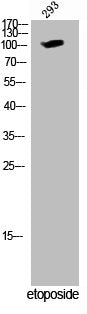 Western Blot analysis of 293 cells using Phospho-Wee1 (S642) Polyclonal Antibody
