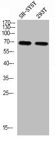 Western blot analysis of SH-SY5Y 293T using p-Splicing factor 1 (S82) antibody.