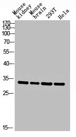 Western blot analysis of Mouse-kidney mouse-brain 293T hela lysis using CA II antibody.