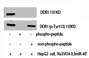 Western Blot analysis of HepG2+NA3VO4 cells using DDR1 Polyclonal Antibody