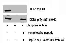 Western Blot analysis of HepG2+NA3VO4 cells using DDR1 Polyclonal Antibody