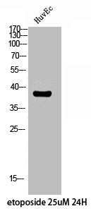Western Blot analysis of HuvEc etoposide 25uM 24H cells using Phospho-Fusin (S339) Polyclonal Antibody