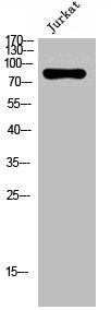 Western Blot analysis of Jurkat cells using Nox5 Polyclonal Antibody