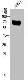 Western Blot analysis of 22RV1 cells using Phospho-CaMKIIβ/γ/δ (T287) Polyclonal Antibody