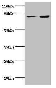 Western blot All lanes: ACSL4 antibody at 2µg/ml Lane 1: HepG2 whole cell lysate Lane 2: Hela whole cell lysate Secondary Goat polyclonal to rabbit IgG at 1/10000 dilution Predicted band size: 80, 75 kDa Observed band size: 80 kDa