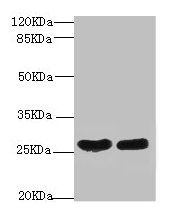 Western blot All lanes: CRP antibody at 2µg/ml Lane 1: High values of serum at 1: 5 Lane 2: High values of serum at 1: 10 Secondary Goat polyclonal to rabbit IgG at 1/10000 dilution Predicted band size: 26, 11 kDa Observed band size: 26 kDa