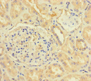 Immunohistochemistry of paraffin-embedded human kidney tissue using CSB-PA06087A0Rb at dilution of 1:100