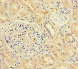 Immunohistochemistry of paraffin-embedded human kidney tissue using CSB-PA06087A0Rb at dilution of 1:100