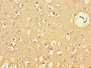 Immunohistochemistry of paraffin-embedded human brain tissue using CSB-PA06119A0Rb at dilution of 1:100