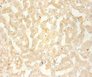 Immunohistochemistry of paraffin-embedded human liver using CSB-PA06139A0Rb at dilution 1:100