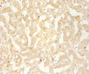 Immunohistochemistry of paraffin-embedded human liver using CSB-PA06139A0Rb at dilution 1:100