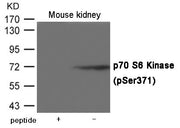 Western blot analysis of extracts from Mouse kidney tissue using p70 S6 Kinase (Ser371) Antibody.The lane on the left is treated with the antigen-specific peptide.