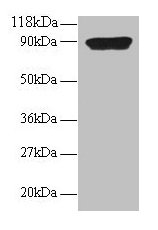 Western blot All lanes: CXCL5 antibody at 2µg/ml + 293T whole cell lysate Secondary Goat polyclonal to rabbit IgG at 1/15000 dilution Predicted band size: 12 kDa Observed band size: 90 kDa