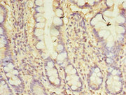 Immunohistochemistry of paraffin-embedded human small intestine tissue using CSB-PA06169A0Rb at dilution of 1:100
