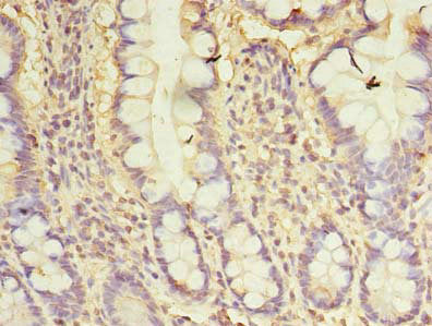 Immunohistochemistry of paraffin-embedded human small intestine tissue using CSB-PA06169A0Rb at dilution of 1:100