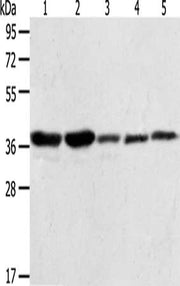 Gel: 10%SDS-PAGE, Lysate: 40 ug, Lane 1-5: A431 cells, NIH/3T3 cells, Hela cells, Jurkat cells, PC3 cells, Primary antibody: CSB-PA061704(ANXA1 Antibody) at dilution 1/400, Secondary antibody: Goat anti rabbit IgG at 1/8000 dilution, Exposure time...