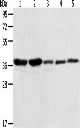 Gel: 10%SDS-PAGE, Lysate: 40 ug, Lane 1-5: A431 cells, NIH/3T3 cells, Hela cells, Jurkat cells, PC3 cells, Primary antibody: CSB-PA061704(ANXA1 Antibody) at dilution 1/400, Secondary antibody: Goat anti rabbit IgG at 1/8000 dilution, Exposure time...