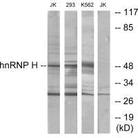 Western blot analysis of extracts from Jurkat cells, 293 cells and K562 cells, using hnRNP H antibody.