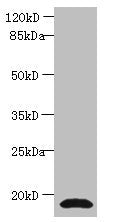 Western blot All lanes: CST3 antibody at 2µg/ml + Human positive serum Secondary Goat polyclonal to rabbit IgG at 1/15000 dilution Predicted band size: 16 kDa Observed band size: 16 kDa