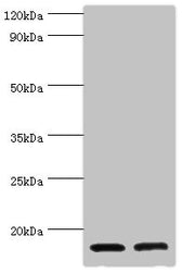 Western blot All lanes: CST3 antibody at 2µg/ml Lane 1: High values of serum at 1: 10 Lane 2: High values of serum at 1: 100 Secondary Goat polyclonal to rabbit IgG at 1/10000 dilution Predicted band size: 16 kDa Observed band size: 16 kDa
