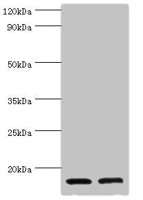 Western blot All lanes: CST3 antibody at 2µg/ml Lane 1: High values of serum at 1: 10 Lane 2: High values of serum at 1: 100 Secondary Goat polyclonal to rabbit IgG at 1/10000 dilution Predicted band size: 16 kDa Observed band size: 16 kDa