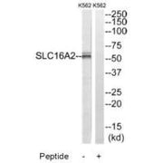 Western blot analysis of extracts from K562 cells, using SLC16A2 antibody.