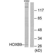 Western blot analysis of extracts from K562 cells, using HOXB9 antibody.