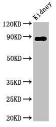 Western Blot Positive WB detected in: Rat kidney tissue All lanes: DPP4 antibody at 2.8ug/ml Secondary Goat polyclonal to rabbit IgG at 1/50000 dilution Predicted band size: 89 kDa Observed band size: 89 kDa
