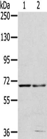 Gel: 6%SDS-PAGE,Lysate: 40 ug,Lane 1-2: 293T cells, HepG2 cells,Primary antibody: CSB-PA062333(MMP24 Antibody) at dilution 1/200 dilution,Secondary antibody: Goat anti rabbit IgG at 1/8000 dilution,Exposure time: 40 seconds