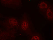 Immunofluorescence staining of methanol-fixed Hela cells using Myc(Phospho-Ser62) Antibody.