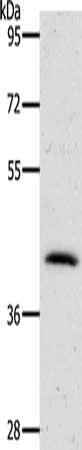 Gel: 10%SDS-PAGE, Lysate: 40 ug, Lane: Mouse lung tissue, Primary antibody: CSB-PA062706(NKX2-1 Antibody) at dilution 1/300, Secondary antibody: Goat anti rabbit IgG at 1/8000 dilution, Exposure time: 1 minute