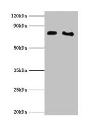 Western blot All lanes: POR antibody at 2µg/ml Lane 1: K562 whole cell lysate Lane 2: A431 whole cell lysate Secondary Goat polyclonal to rabbit IgG at 1/10000 dilution Predicted band size: 77 kDa Observed band size: 77 kDa